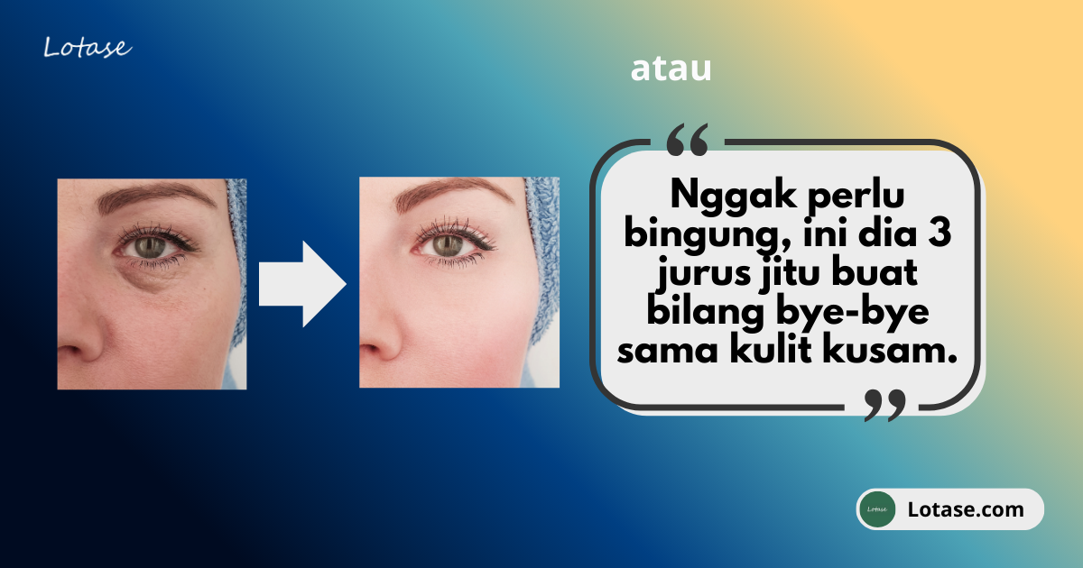 Cara Mengatasi Wajah Kusam & Lelah, Ini Dia Kombinasi Lotase untuk Balikin Cahayanya!!