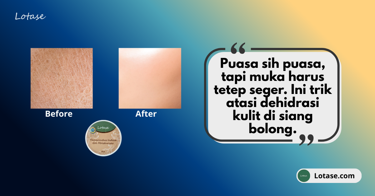 Bibir Kering & Muka Layu Pas Puasa? Jangan Sampe Kelihatan Zombie Dong Beb!